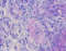 //rprorwxhrkinlm5q-static.micyjz.com/cloud/ljBpjKnjlkSRqimpqmmoim/G1047-100ML-60-60.jpg