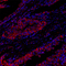 //rprorwxhrkinlm5q-static.micyjz.com/cloud/lkBpjKnjlkSRqippqjopip/cca741b164f82a5d44f88f311d570d9b-60-60.jpg