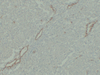GB14071 मानव एंटी-क्लाउडिन 7 डिटेक्शन माउस मैब