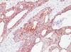 मानव immunoblotting प्राथमिक एंटीबॉडी के लिए एंटी-एचएसपी 60 माउस मैब