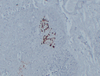 मानव IHC के लिए एंटी-चिकनुसागोन माउस मैब अगर प्राथमिक एंटीबॉडी