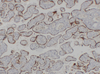 मानव immunoblotting monoclonal एंटीबॉडी के लिए एंटी-एचसीजी बीटा माउस माॅब
